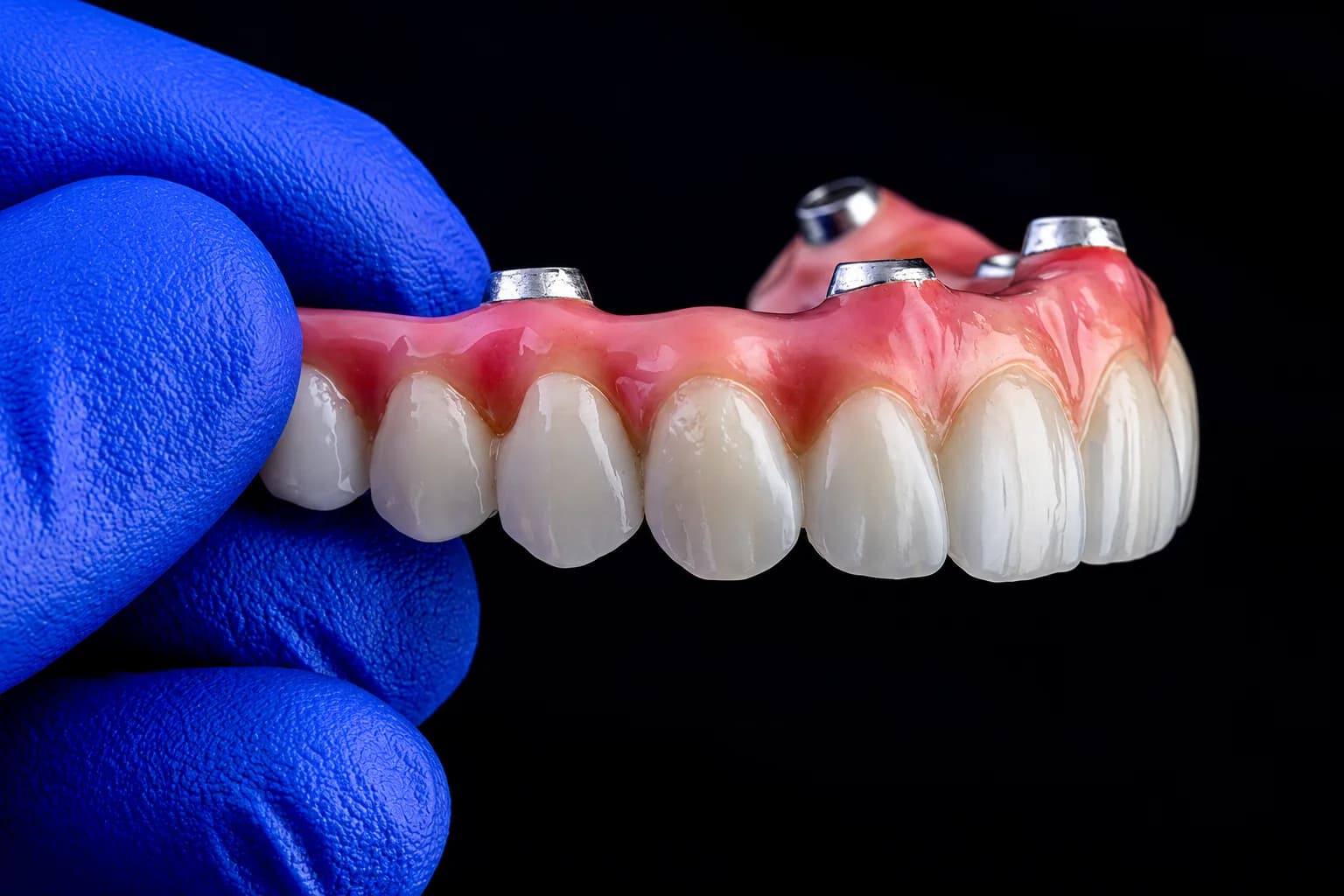 Prótese protocolo sobre implantes, segurada por mão enluvada